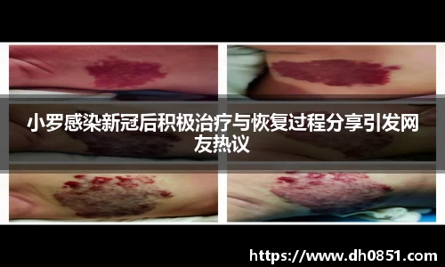 小罗感染新冠后积极治疗与恢复过程分享引发网友热议